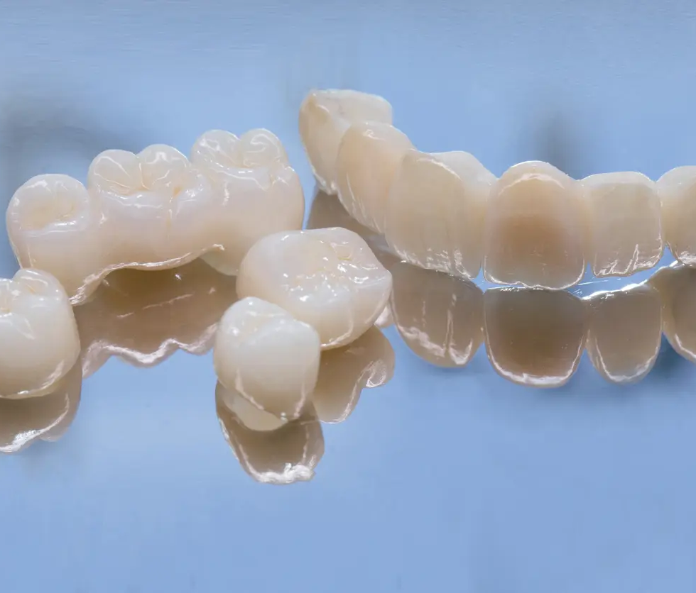 金属アレルギーが心配な方も安心！メタルフリー治療のご提案