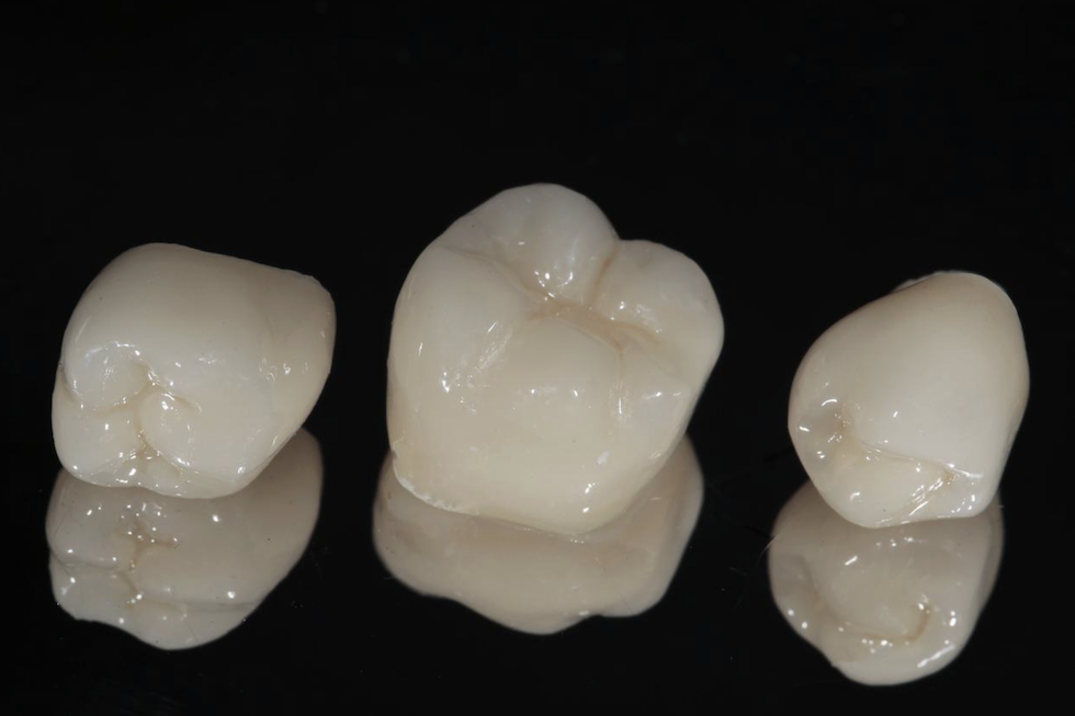 セラミッククラウン/セラミックインレー