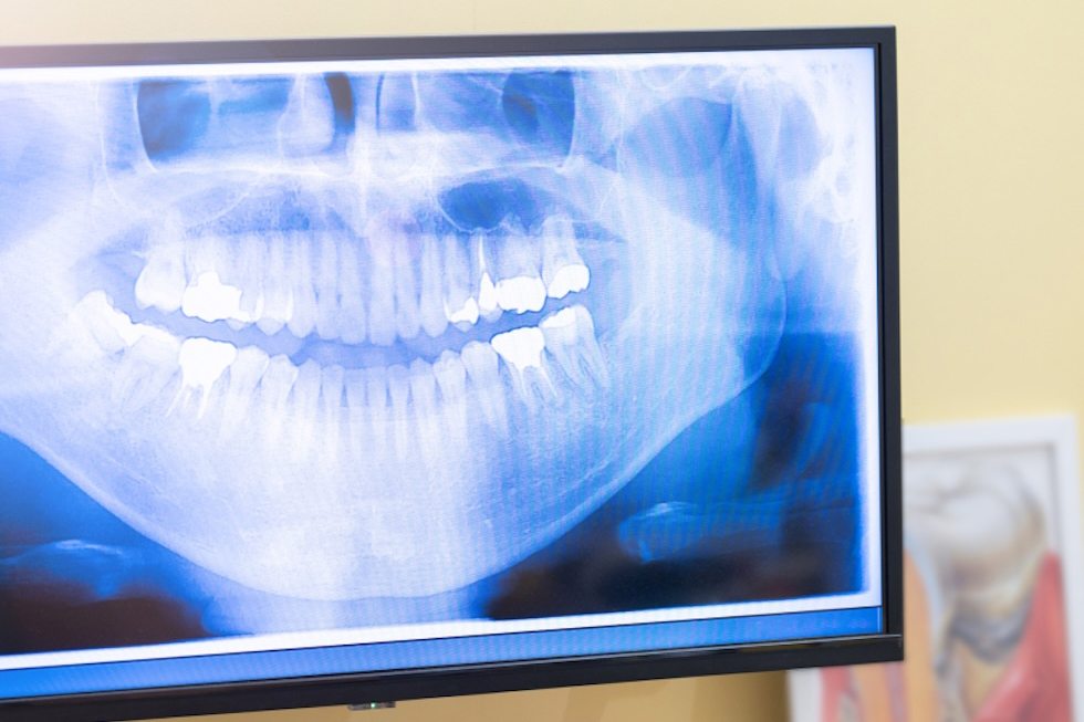 検査・レントゲン撮影